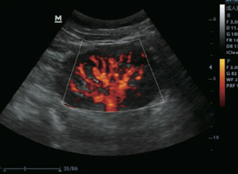 Veterinary Color Doppler Ultrasound & Micro convex probe for Small animals DIAGNOSTIC ULTRASOUND MACHINES FOR SALE