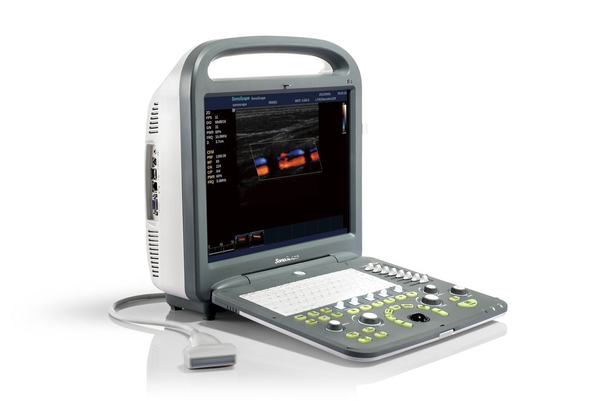 Sonoscape S2 Color Doppler Portable Ultrasound & Linear Array Probe L741 Demo DIAGNOSTIC ULTRASOUND MACHINES FOR SALE