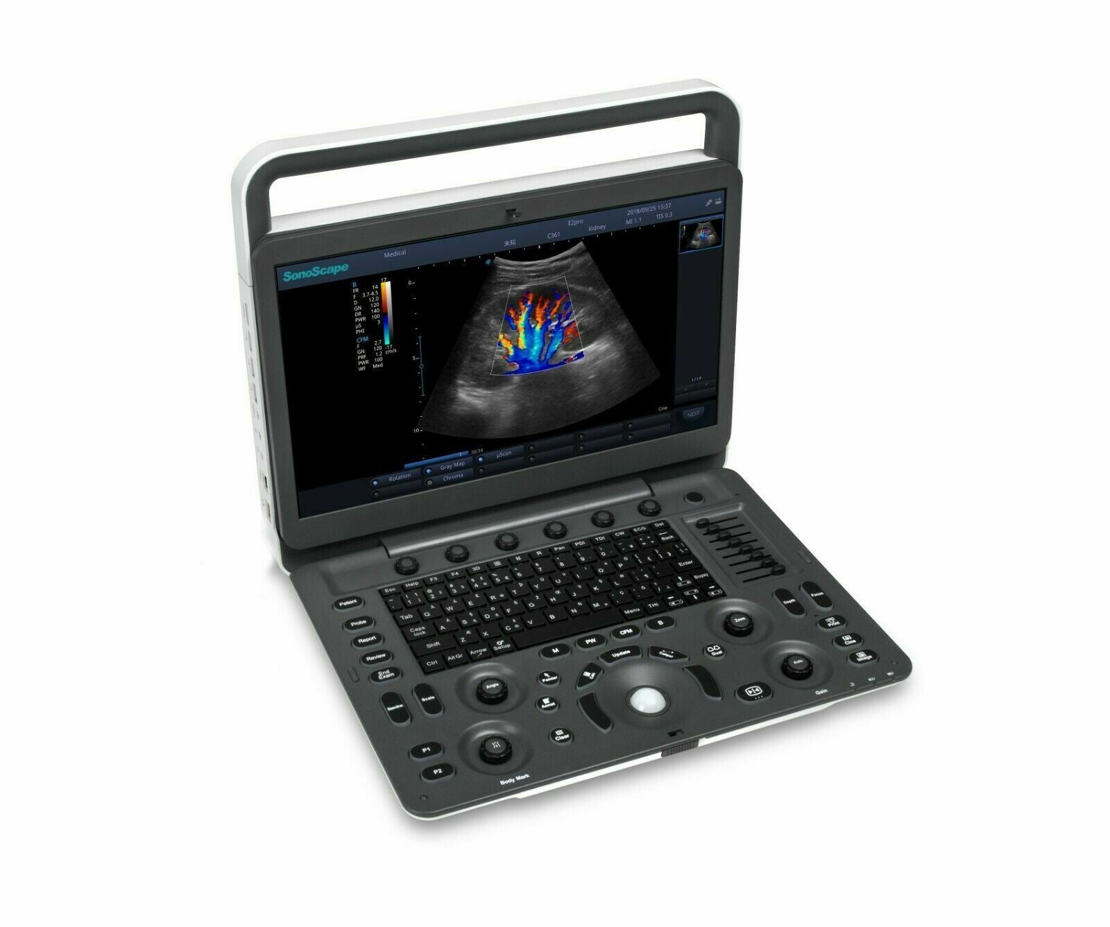 Demo SonoScape E2 Ultrasound with One Linear Array Probe DIAGNOSTIC ULTRASOUND MACHINES FOR SALE