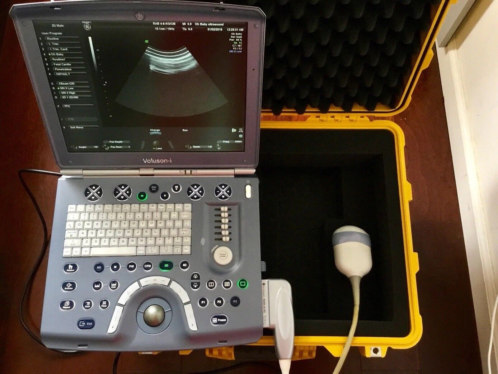 GE VOLUSON E PORTABLE ULTRASOUND MACHINE WITH 1 RAB 4D PROBE DIAGNOSTIC ULTRASOUND MACHINES FOR SALE