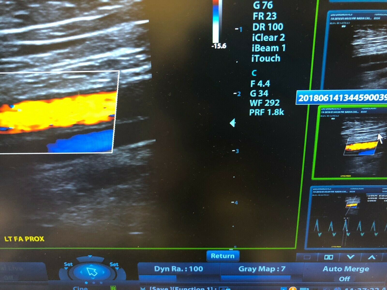 Mindray M9 Portable Ultrasound With  Two Probes (L12-4S) (C5-1S) DIAGNOSTIC ULTRASOUND MACHINES FOR SALE