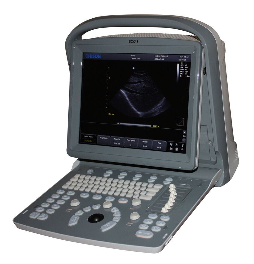 Chison ECO1 Portable Ultrasound Machine, Quality, LED, Linear & Printer Included DIAGNOSTIC ULTRASOUND MACHINES FOR SALE