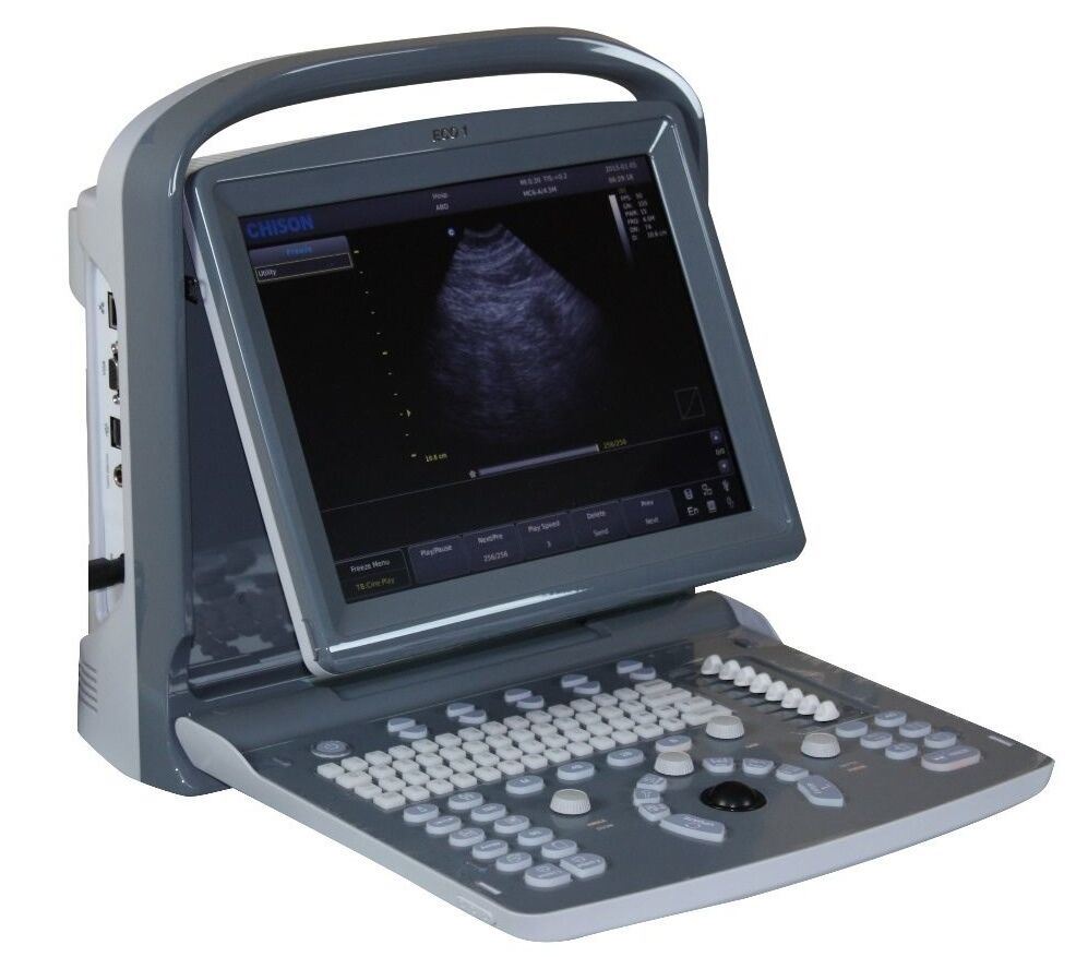 Chison ECO1 Portable Ultrasound Machine, Quality, LED, Linear & Printer Included DIAGNOSTIC ULTRASOUND MACHINES FOR SALE