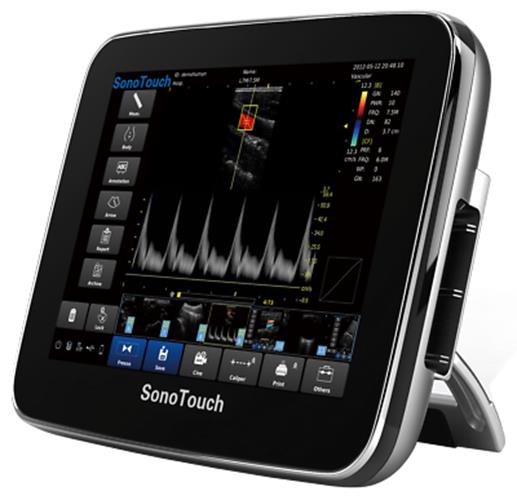 Chison Sonotouch 30 Color Doppler Ultrasound Scanner with linear array probe L7S DIAGNOSTIC ULTRASOUND MACHINES FOR SALE