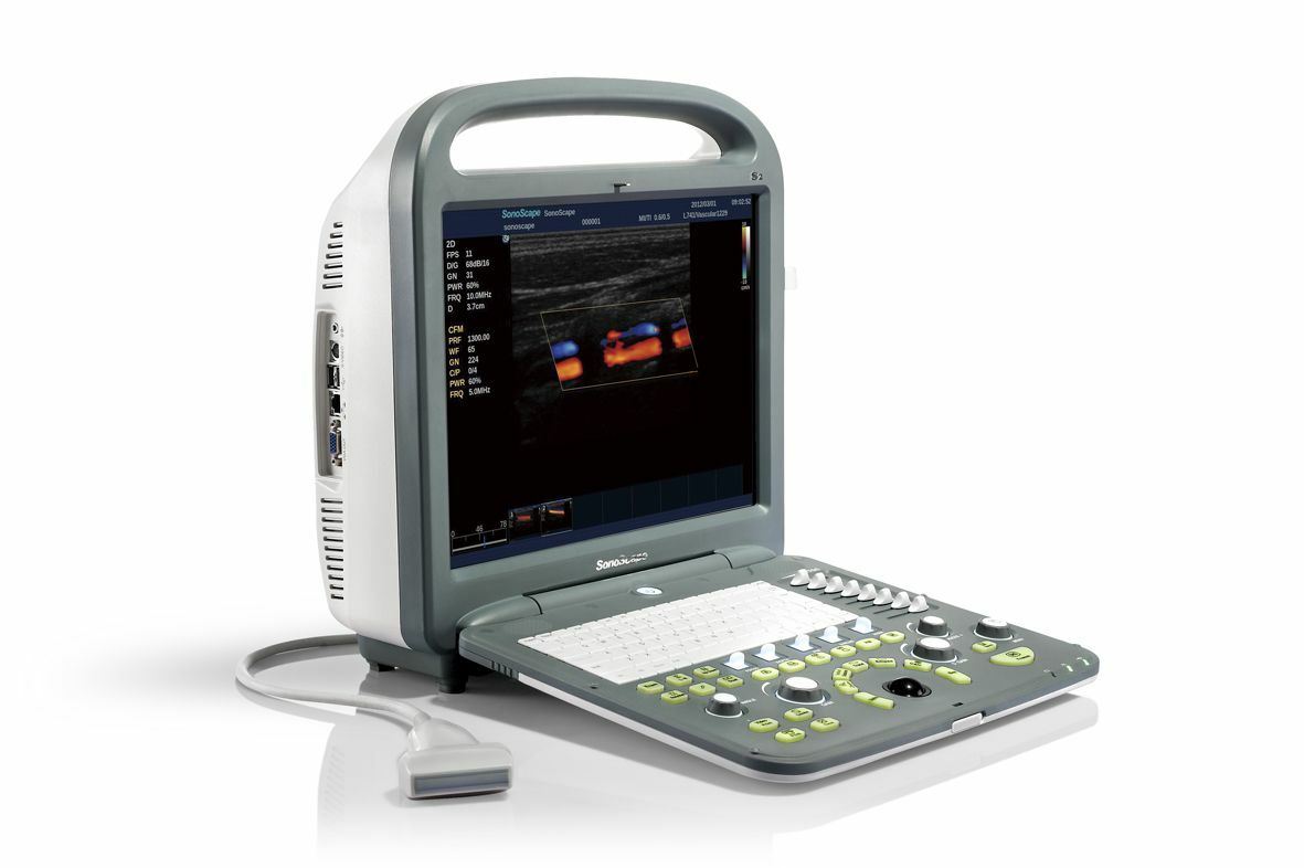 SonoScape S2 with one Linear array  Probe L741  5.0-10.0 Mhz DIAGNOSTIC ULTRASOUND MACHINES FOR SALE