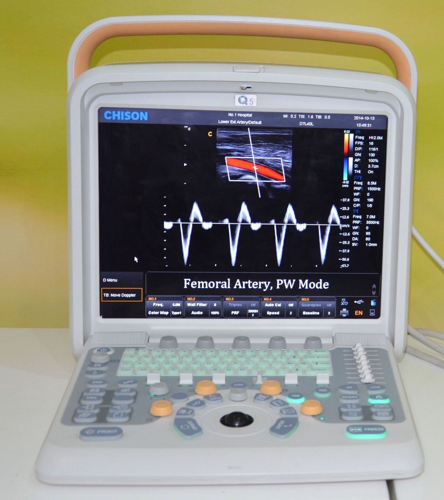 Color Doppler Ultrasound Chison Q5, with 4D Probe for Obstetrics and Gynecology DIAGNOSTIC ULTRASOUND MACHINES FOR SALE