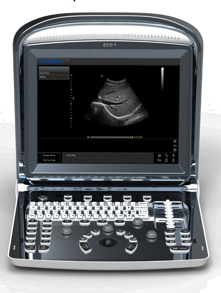 Chison ECO1 Portable LED Ultrasound Scanner two probes Convex &  linear array DIAGNOSTIC ULTRASOUND MACHINES FOR SALE