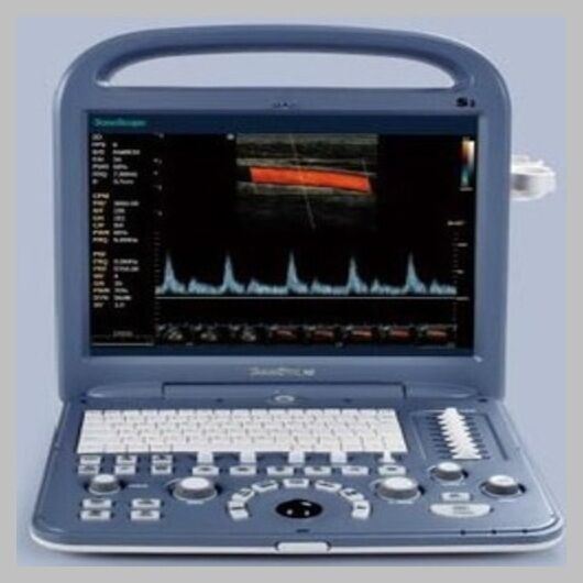 SonoScape S2 with convex Probe Abdominal Ultrasound new DIAGNOSTIC ULTRASOUND MACHINES FOR SALE