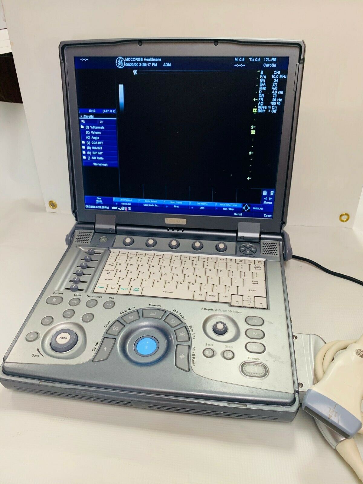 GE Logiq E Color Ultrasound Scanner, 3 probes Cardiac,Linear, convex  2011 DIAGNOSTIC ULTRASOUND MACHINES FOR SALE