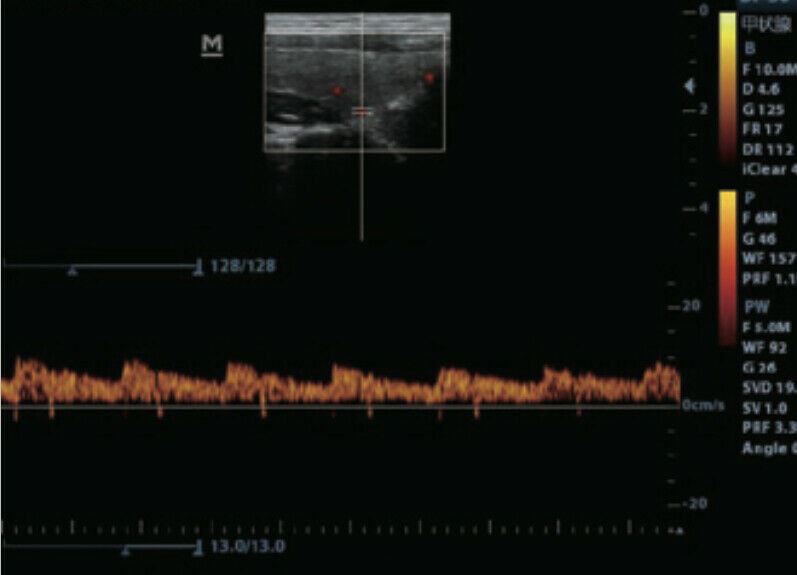 Erschwingliche Farbe Doppler Ultraschall Zwei Sonden Konvex & Lineare Anordnung DIAGNOSTIC ULTRASOUND MACHINES FOR SALE