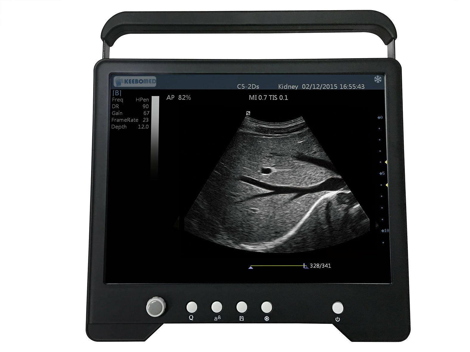 Veterinary Large & Small Animal Touch Screen Ultrasound with 3 Probes | KeeboMed DIAGNOSTIC ULTRASOUND MACHINES FOR SALE