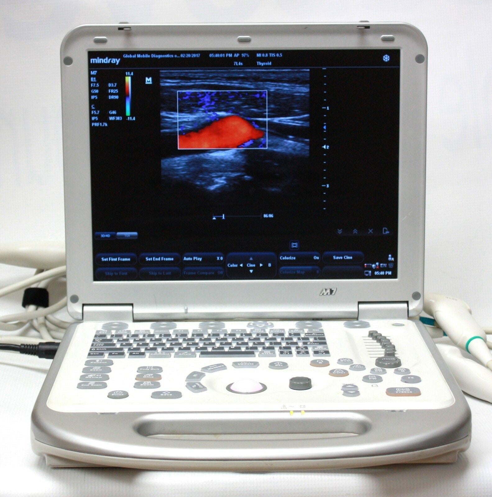 Mindray M7 Color Doppler Ultrasound 2017, 2 Probes, in excellent condition DIAGNOSTIC ULTRASOUND MACHINES FOR SALE