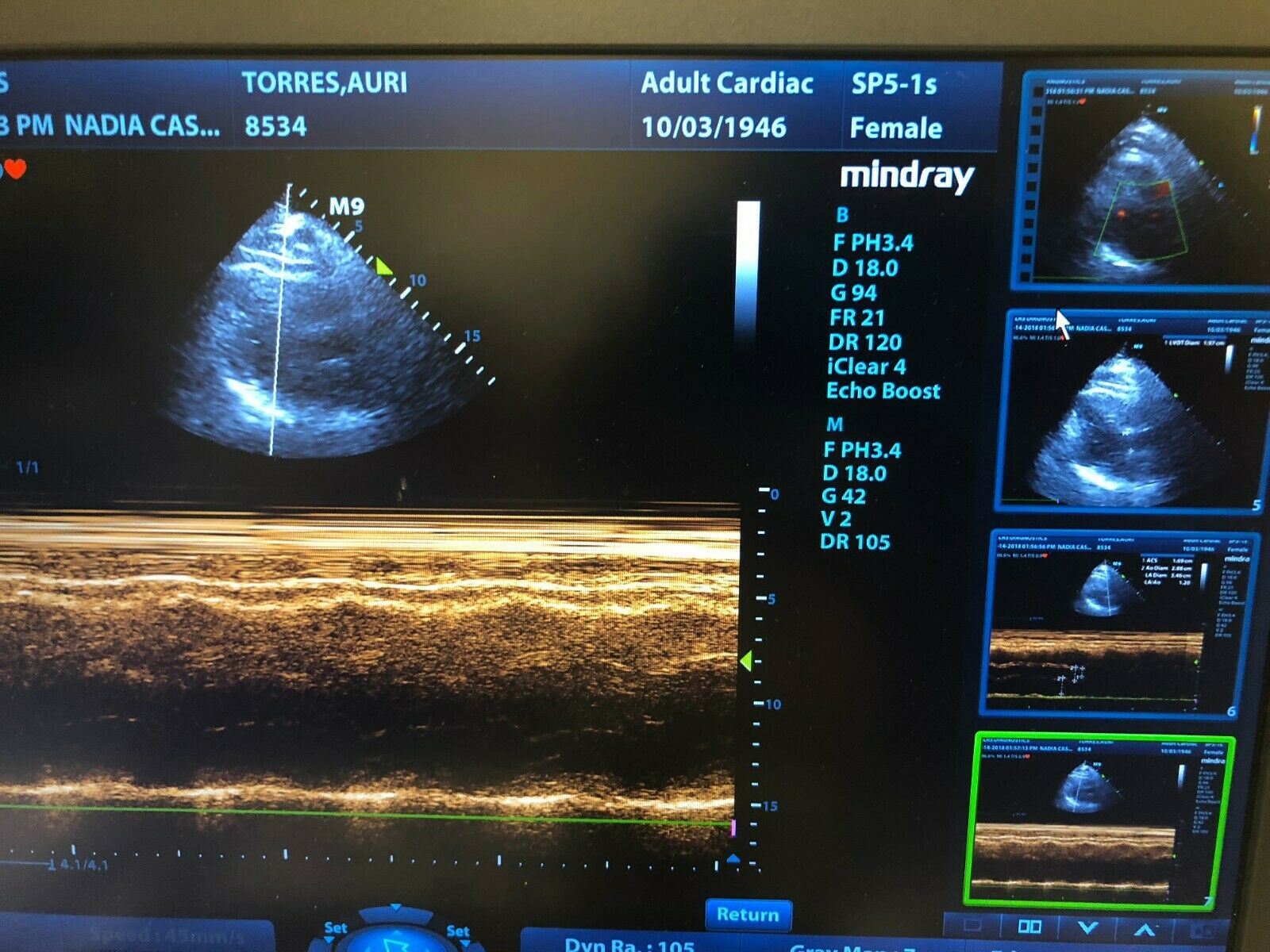 Mindray M9 Portable Ultrasound with 1 probes Phased array adult Cardiac DIAGNOSTIC ULTRASOUND MACHINES FOR SALE