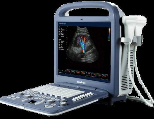 SonoScape S2 with one Trans vaginal Probe New DIAGNOSTIC ULTRASOUND MACHINES FOR SALE