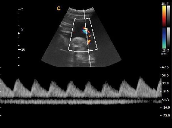 Veterinary Ultrasound Chison Ebit 30 Color Doppler & Micro-Convex Probe DIAGNOSTIC ULTRASOUND MACHINES FOR SALE