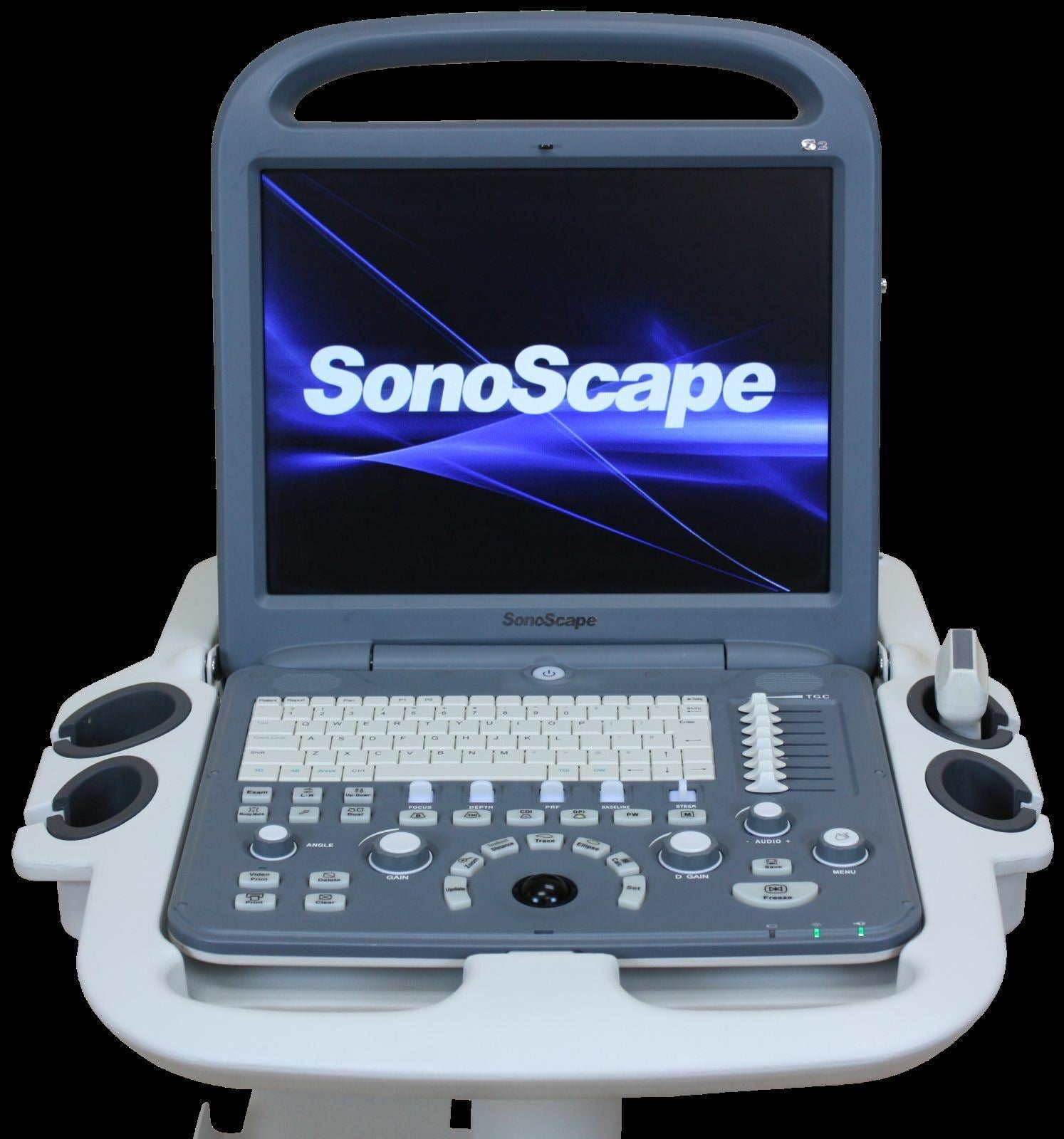 SonoScape S2 with Convex Abdominal Probe Included -  Excellent Condition DIAGNOSTIC ULTRASOUND MACHINES FOR SALE