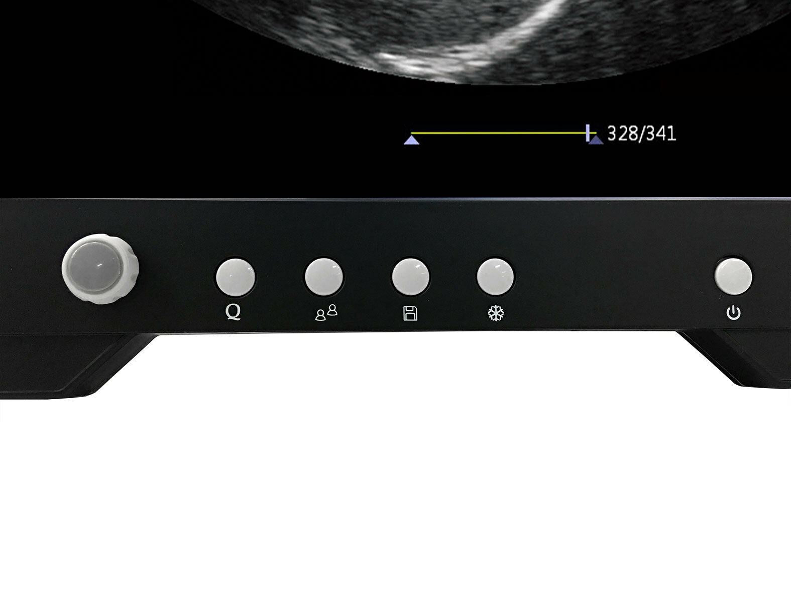 Veterinary Large & Small Animal Touch Screen Ultrasound w/ Two Probes | KeeboMed DIAGNOSTIC ULTRASOUND MACHINES FOR SALE