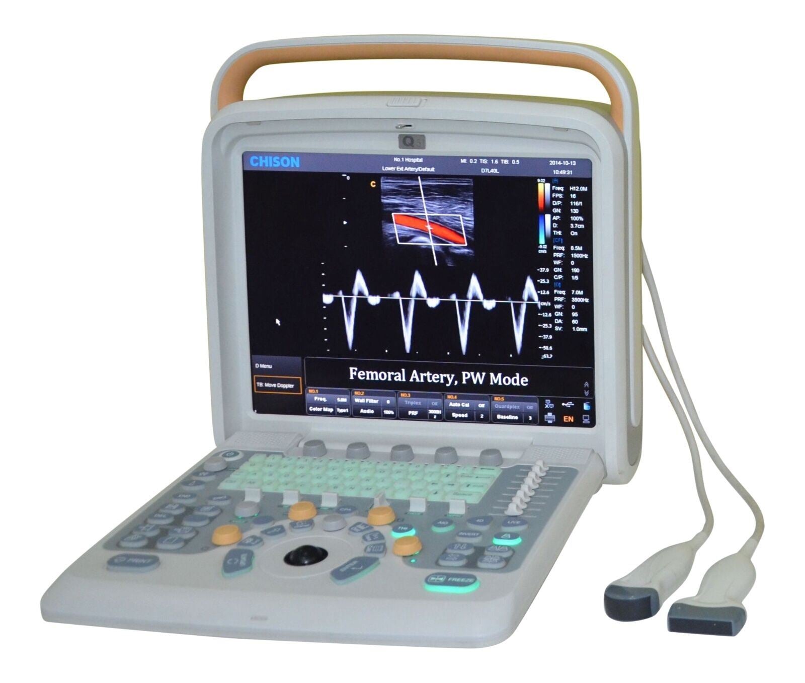 Veterinary Ultrasound Scanner with 2 Probes - Color Doppler Chison Q5Vet DIAGNOSTIC ULTRASOUND MACHINES FOR SALE