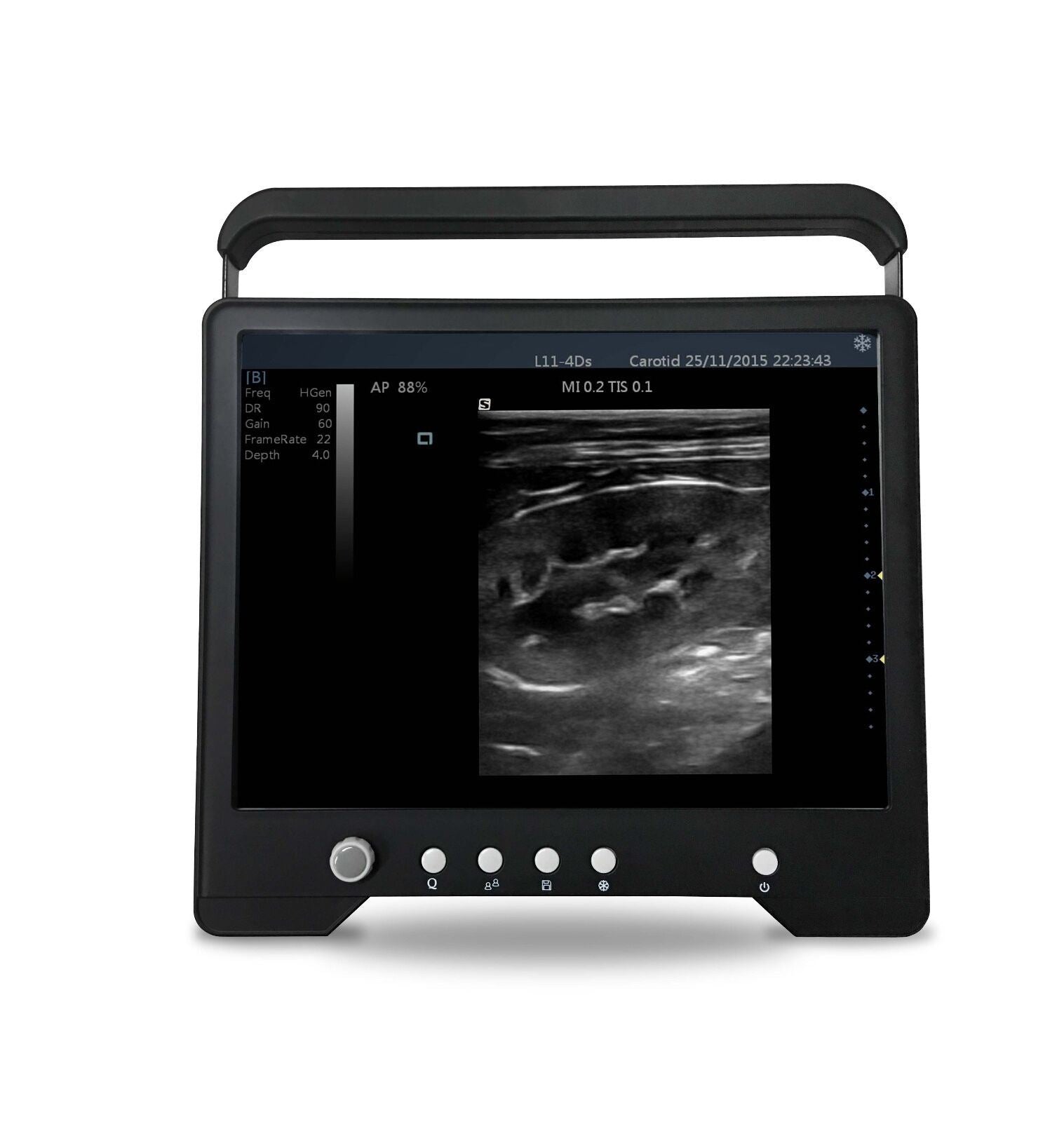 Tierärztlich Touchscreen Ultrasound&micro-convex Sonde für Klein Tiere, Keebomed DIAGNOSTIC ULTRASOUND MACHINES FOR SALE