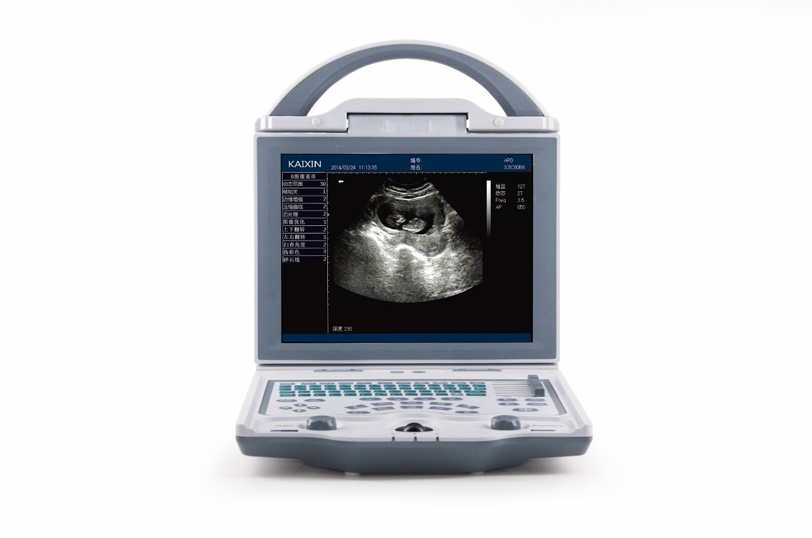 Newest-Light Poids Portable Ultrasons & un Sonde, Dicom ,Ecran LED DIAGNOSTIC ULTRASOUND MACHINES FOR SALE