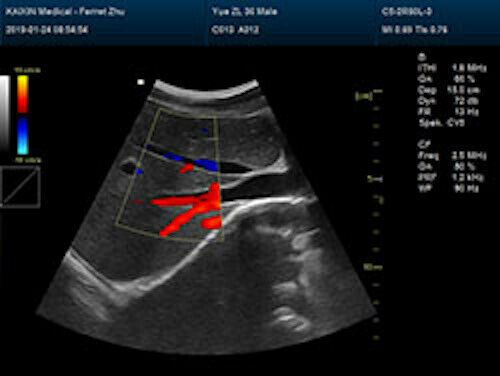 Newest- Color Portable Ultrasound & One Probe, DICOM, LED screen DIAGNOSTIC ULTRASOUND MACHINES FOR SALE