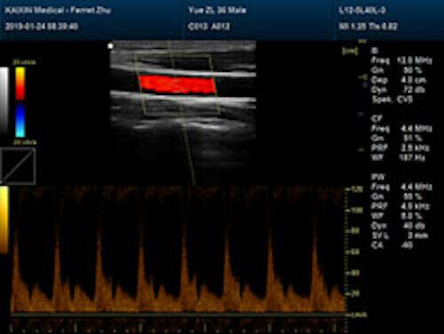 Newest- Color Portable Ultrasound & One Probe, DICOM, LED screen DIAGNOSTIC ULTRASOUND MACHINES FOR SALE