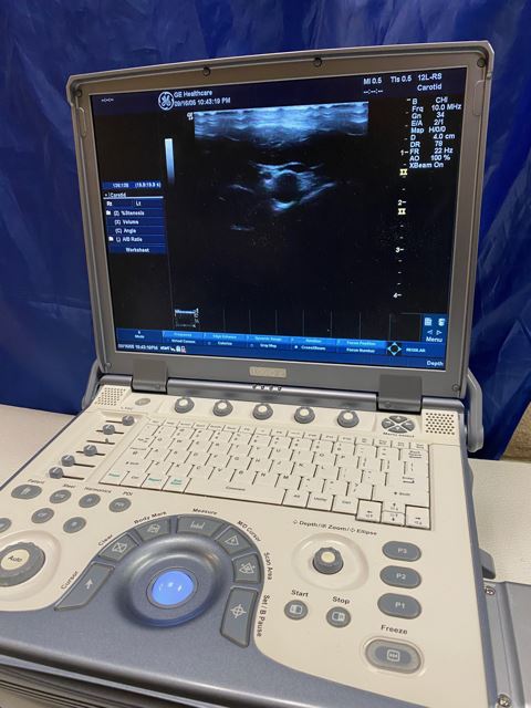 GE LOGIQ E Portable Ultrasound & phased array cardiac probe 3S-RS-Refurbished DIAGNOSTIC ULTRASOUND MACHINES FOR SALE