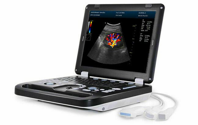 DCU-50Vet Veterinary Laptop Ultrasound with Micro Convex Probe DIAGNOSTIC ULTRASOUND MACHINES FOR SALE