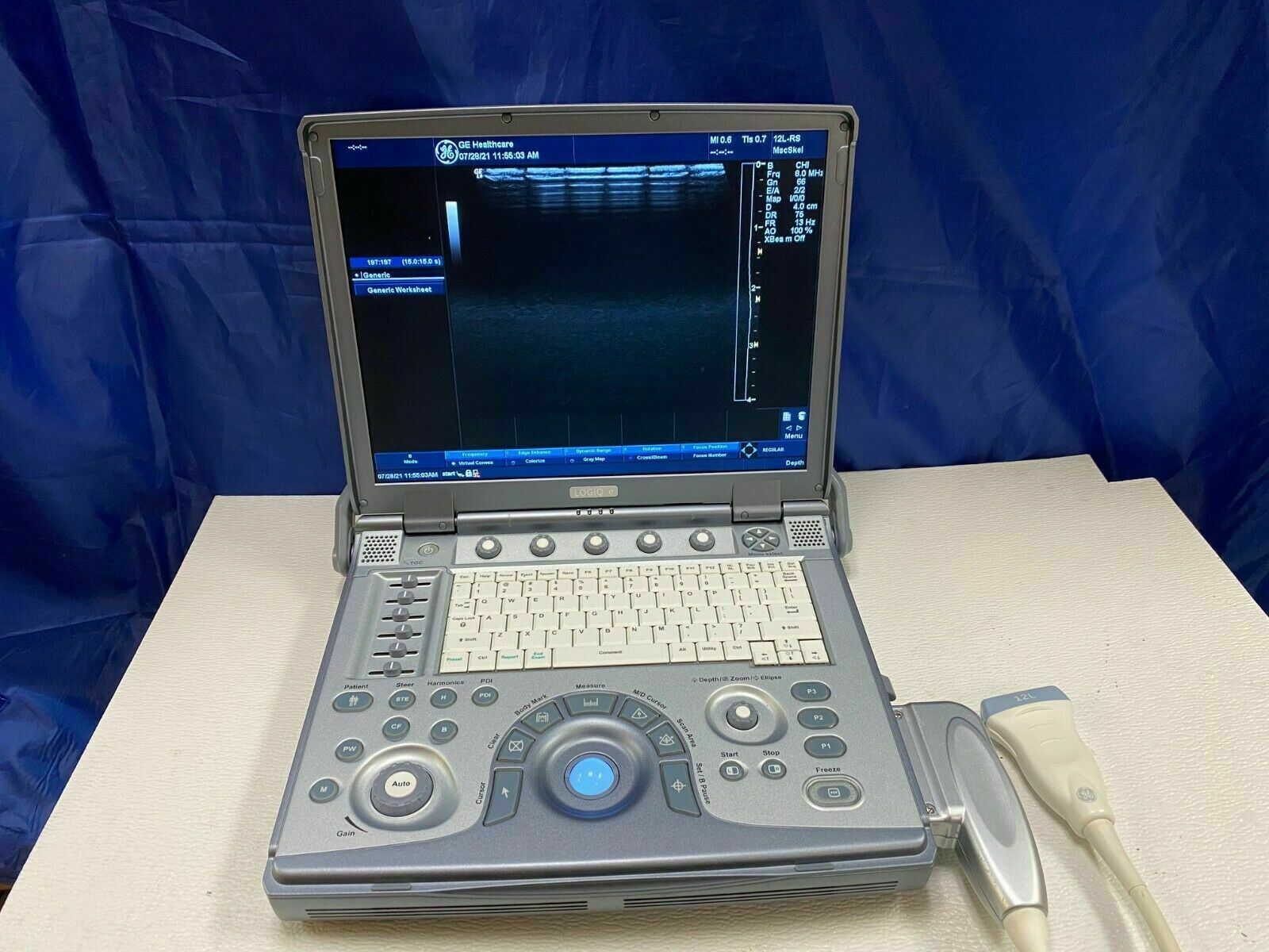 GE LOGIQ E PORTABLE ULTRASOUND MACHINE WITH 1 PROBE (12L) MANUFACTURED 2010 DIAGNOSTIC ULTRASOUND MACHINES FOR SALE