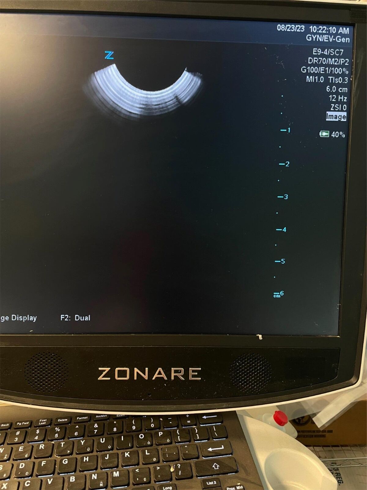 ZONARE E9-4 Ultrasound Probe Transducer DIAGNOSTIC ULTRASOUND MACHINES FOR SALE