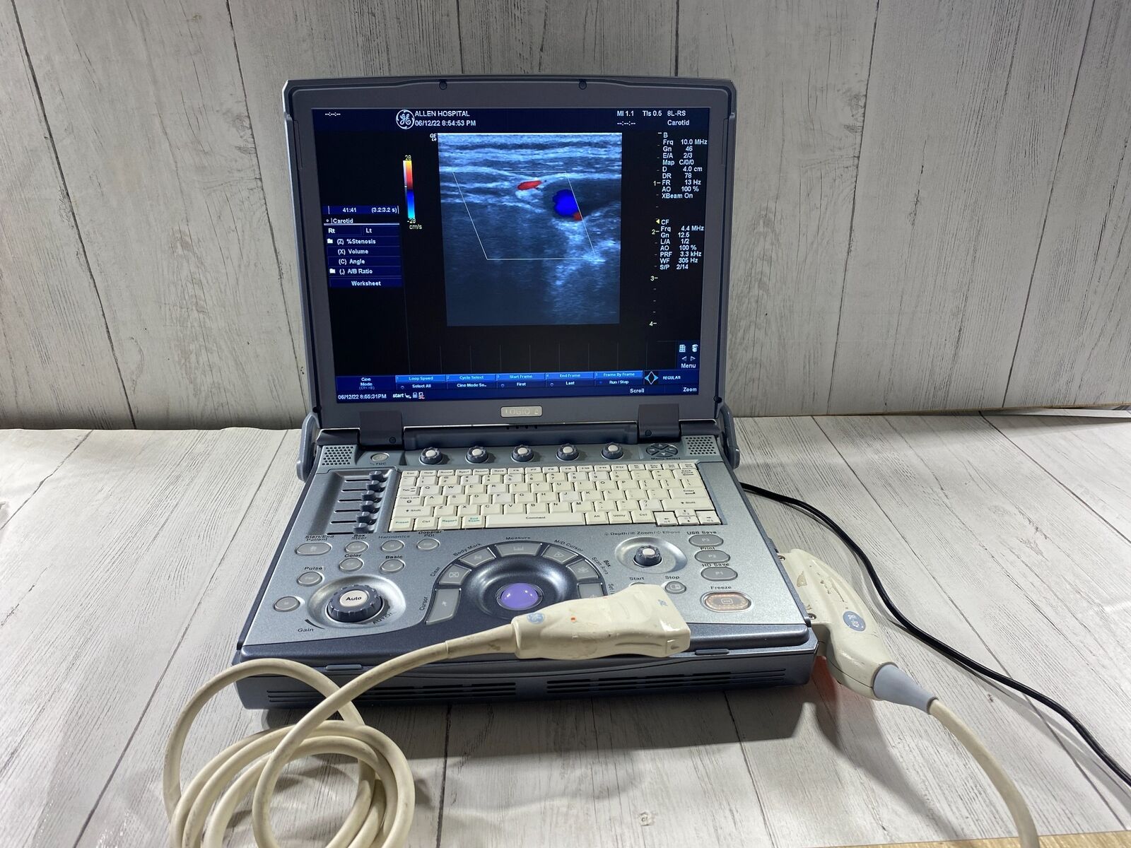 GE LogiQ E portable ultrasound DIAGNOSTIC ULTRASOUND MACHINES FOR SALE