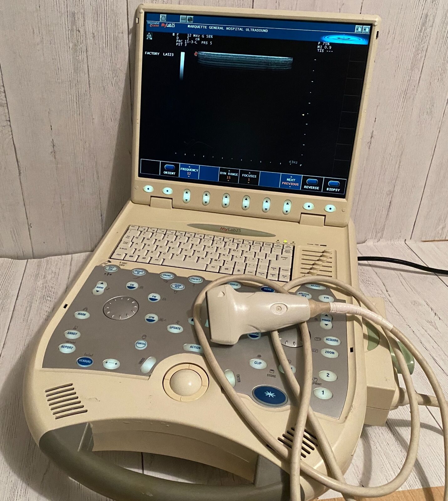 Esaote BioSound MyLab25  Portable Ultrasound with linear array probe  2005 DIAGNOSTIC ULTRASOUND MACHINES FOR SALE