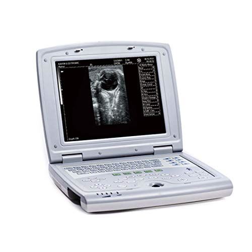 KX5000V Veterinary Laptop Ultrasound-Large Animal-Bovine/Horse- Keebomed DIAGNOSTIC ULTRASOUND MACHINES FOR SALE