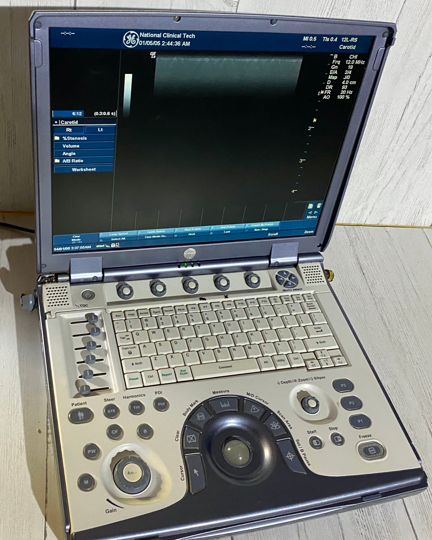 Ge Logic E portable Ultrasound machine with one linear array probe L8-8S DIAGNOSTIC ULTRASOUND MACHINES FOR SALE