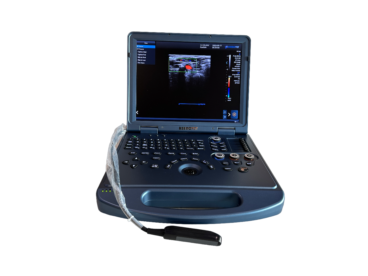 ECO-17Vet High end Equine Ultrasound with Rectal Probe  4-12 MHz Color Doppler DIAGNOSTIC ULTRASOUND MACHINES FOR SALE