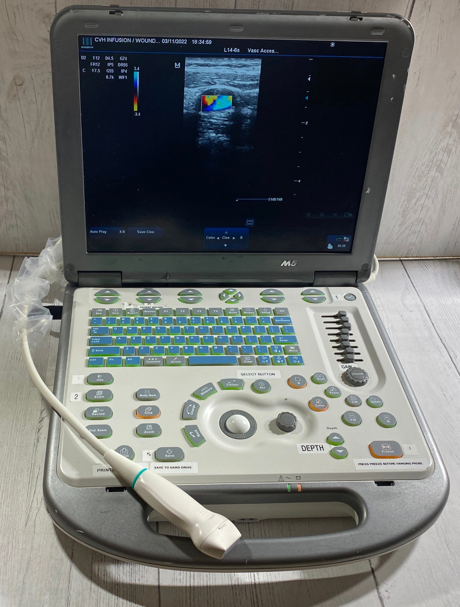 Mindray M5 Portable Ultraspund with one linear array probe DIAGNOSTIC ULTRASOUND MACHINES FOR SALE