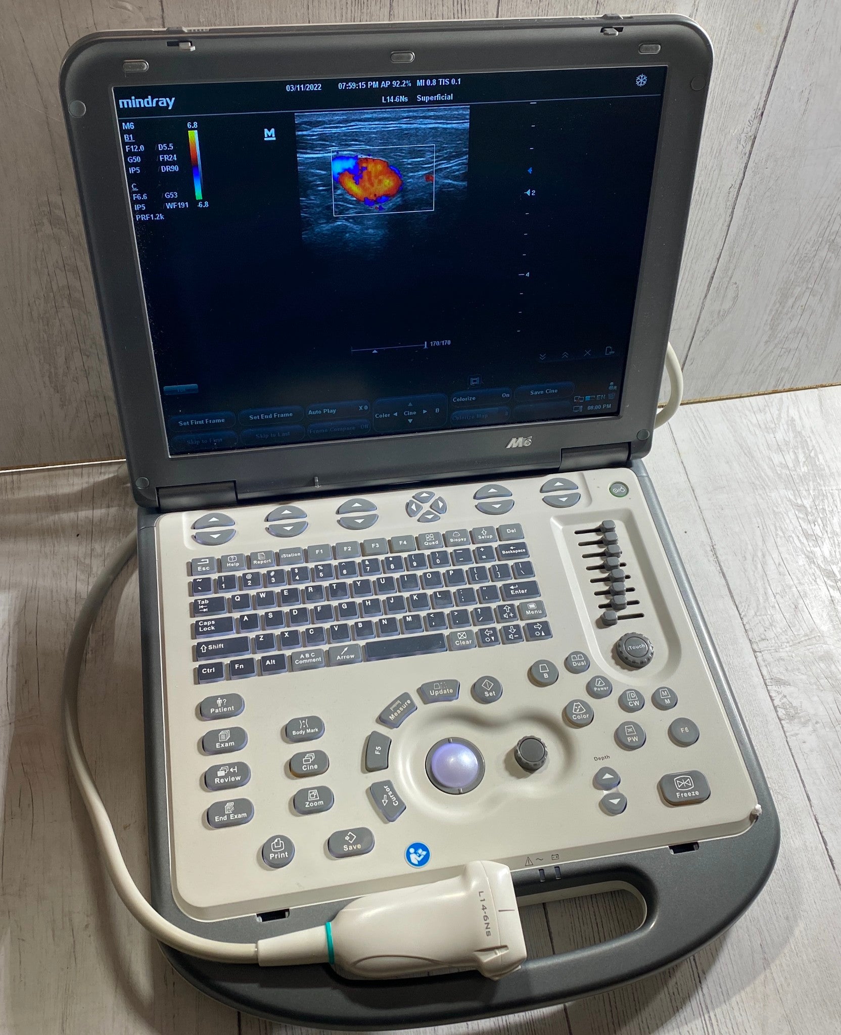 Mindray M6 Portable Ultraspund with one linear array probe L14-6NS   2018 DIAGNOSTIC ULTRASOUND MACHINES FOR SALE