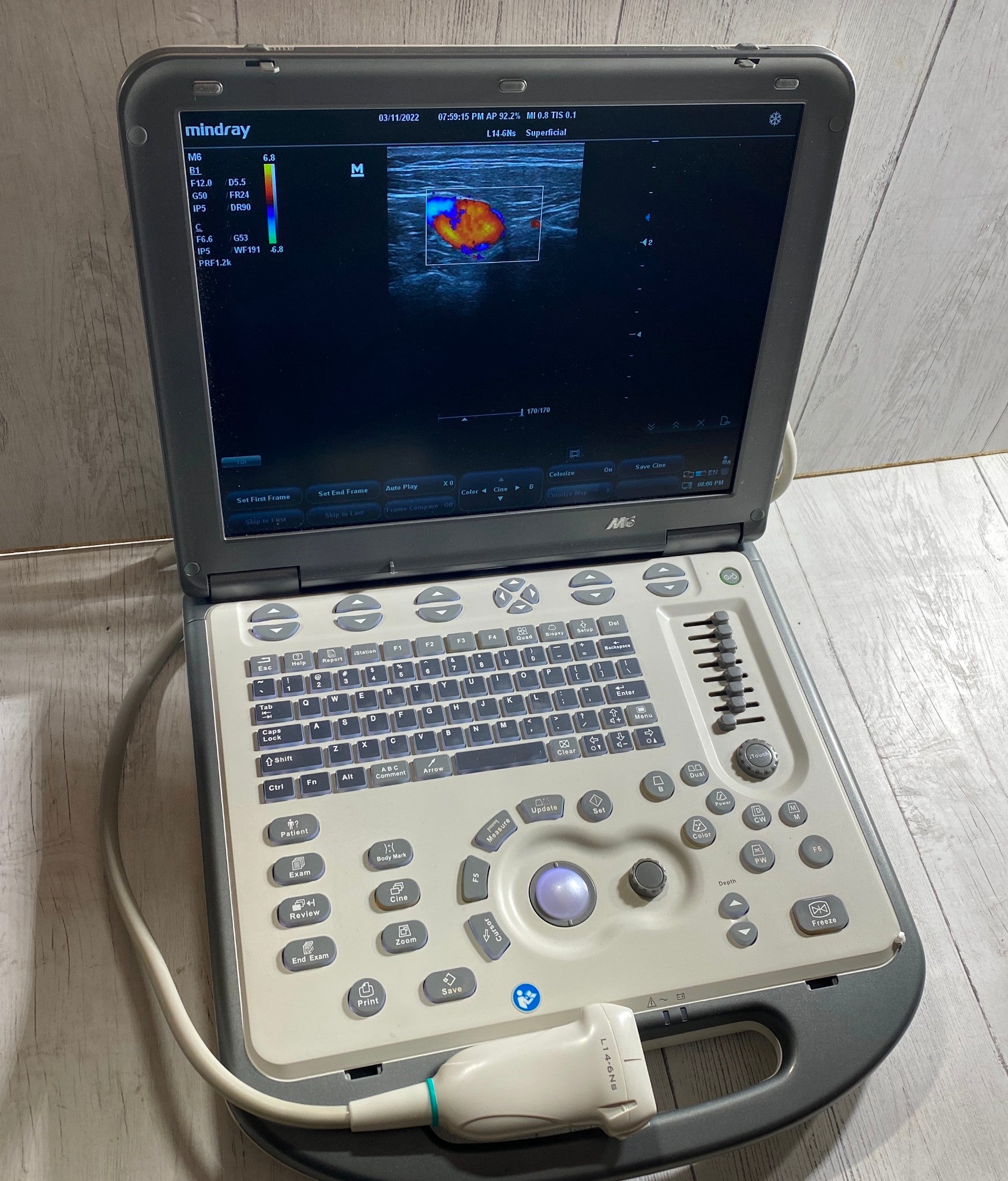 Mindray M6 Portable Ultraspund with one linear array probe L14-6NS   2018 DIAGNOSTIC ULTRASOUND MACHINES FOR SALE