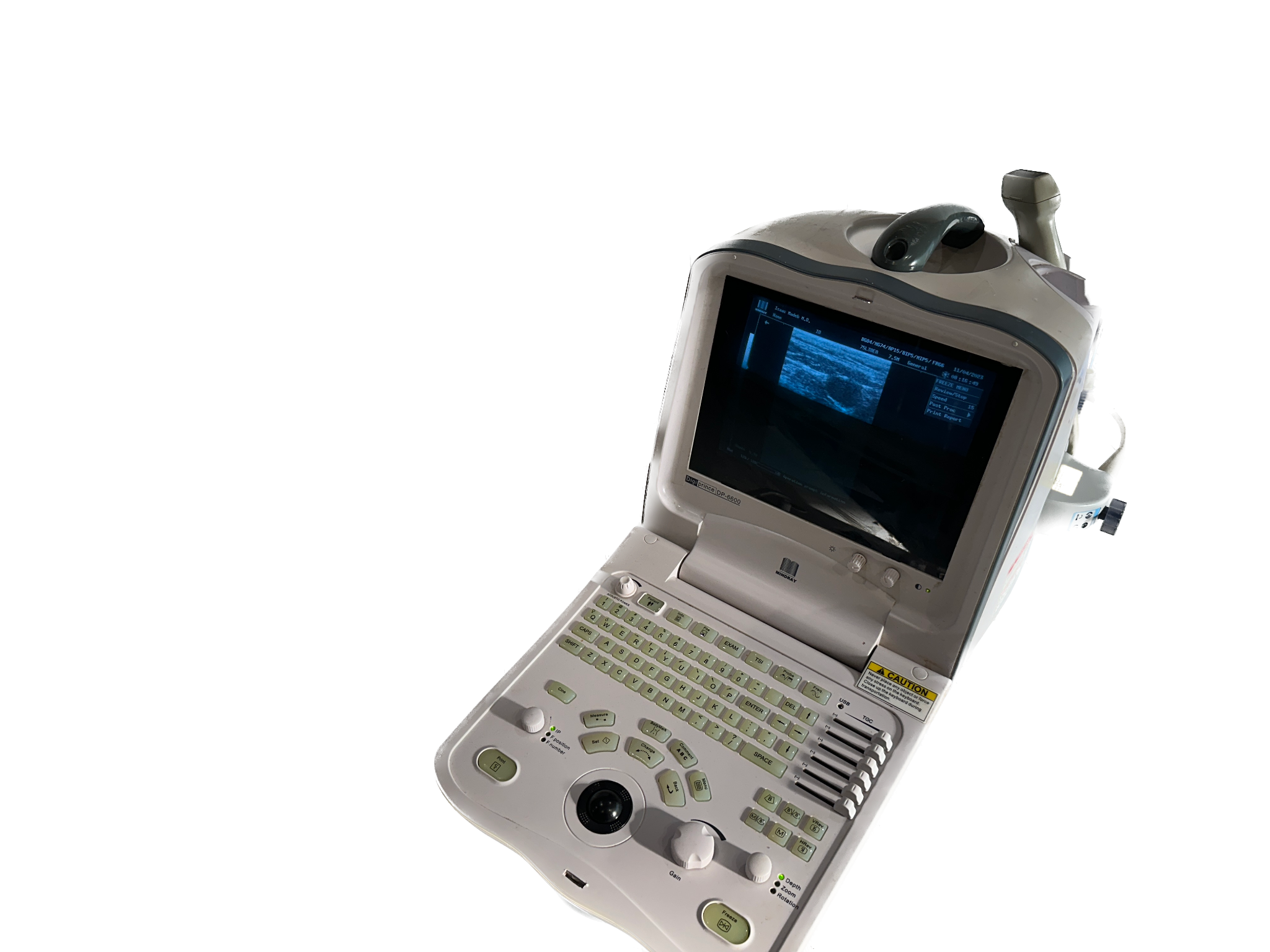 MINDRAY DP6600 Ultrasound with one linear Array Probe  75L38EA DIAGNOSTIC ULTRASOUND MACHINES FOR SALE