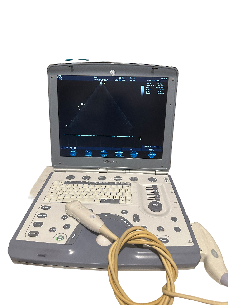 GE Vivid I Color Doppler Ultrasound Scanner & 3S-RS Phased Array Cardiac Probe DIAGNOSTIC ULTRASOUND MACHINES FOR SALE