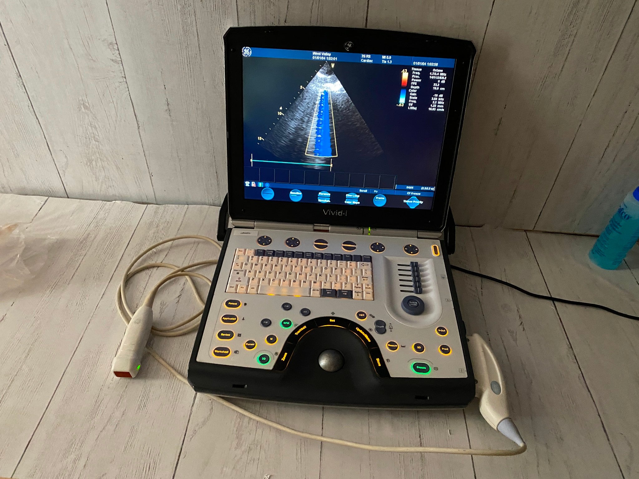 GE Vivid I  Color Doppler Ultrasound Scanner, CW  BT10 with 3s-RS cardiac probe DIAGNOSTIC ULTRASOUND MACHINES FOR SALE