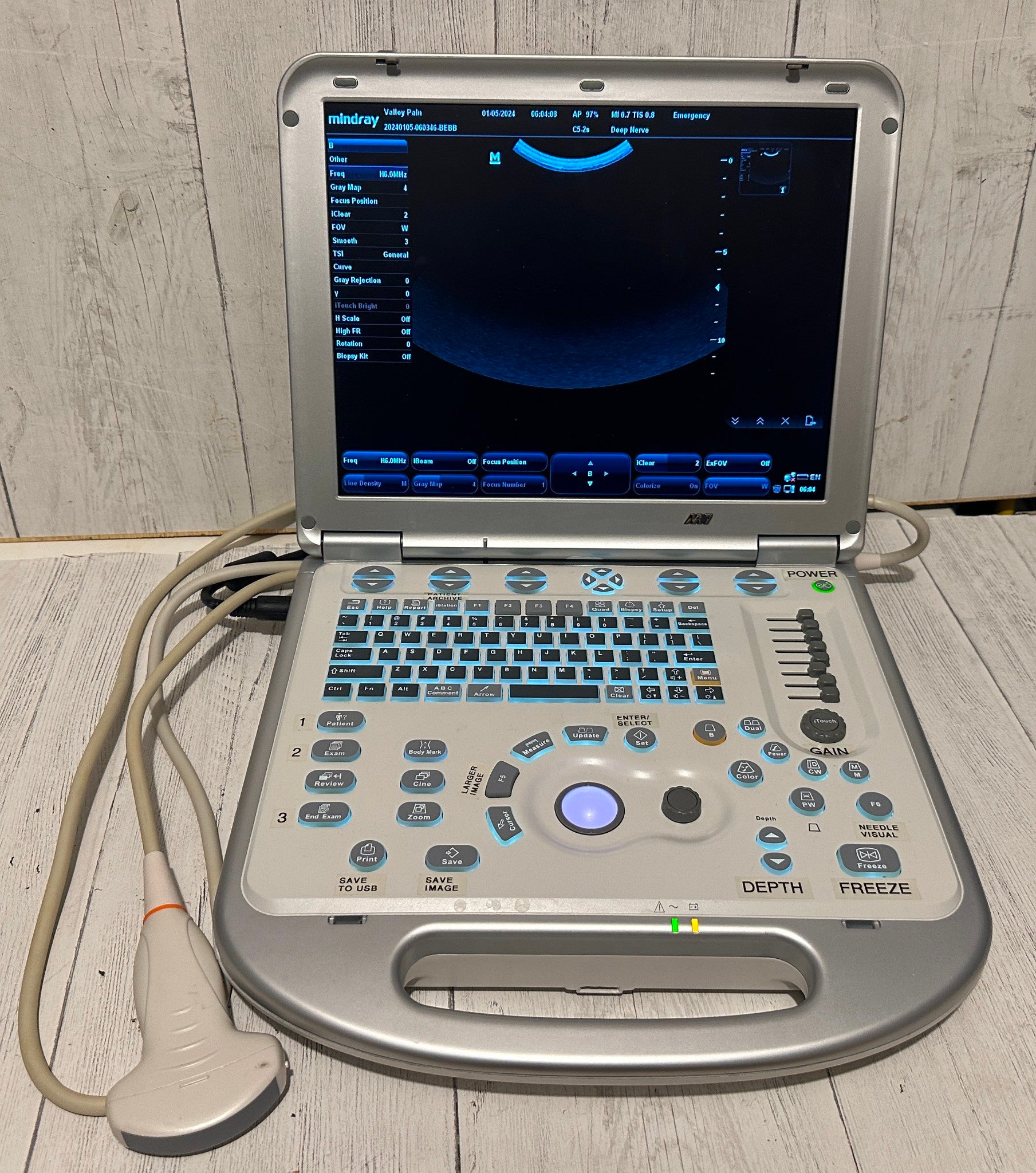 Mindray M7 Ultrasound Machine With 2 Probes (C5-2S, L14-6NS) & Hard Rolling Case DIAGNOSTIC ULTRASOUND MACHINES FOR SALE