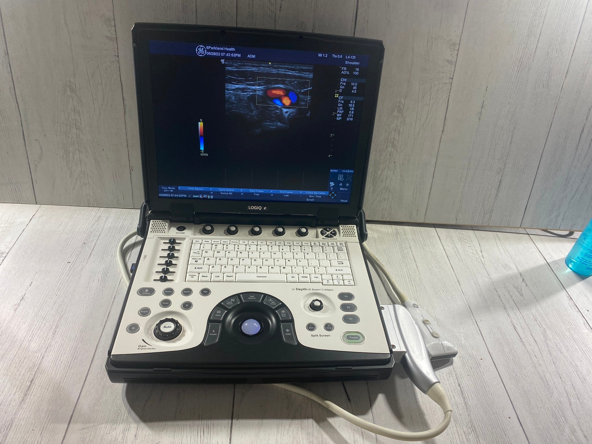 GE LOGIQ E Next Generation Ultrasound machine & Probe -L4-12T DOM 2014 R8.0.4 DIAGNOSTIC ULTRASOUND MACHINES FOR SALE