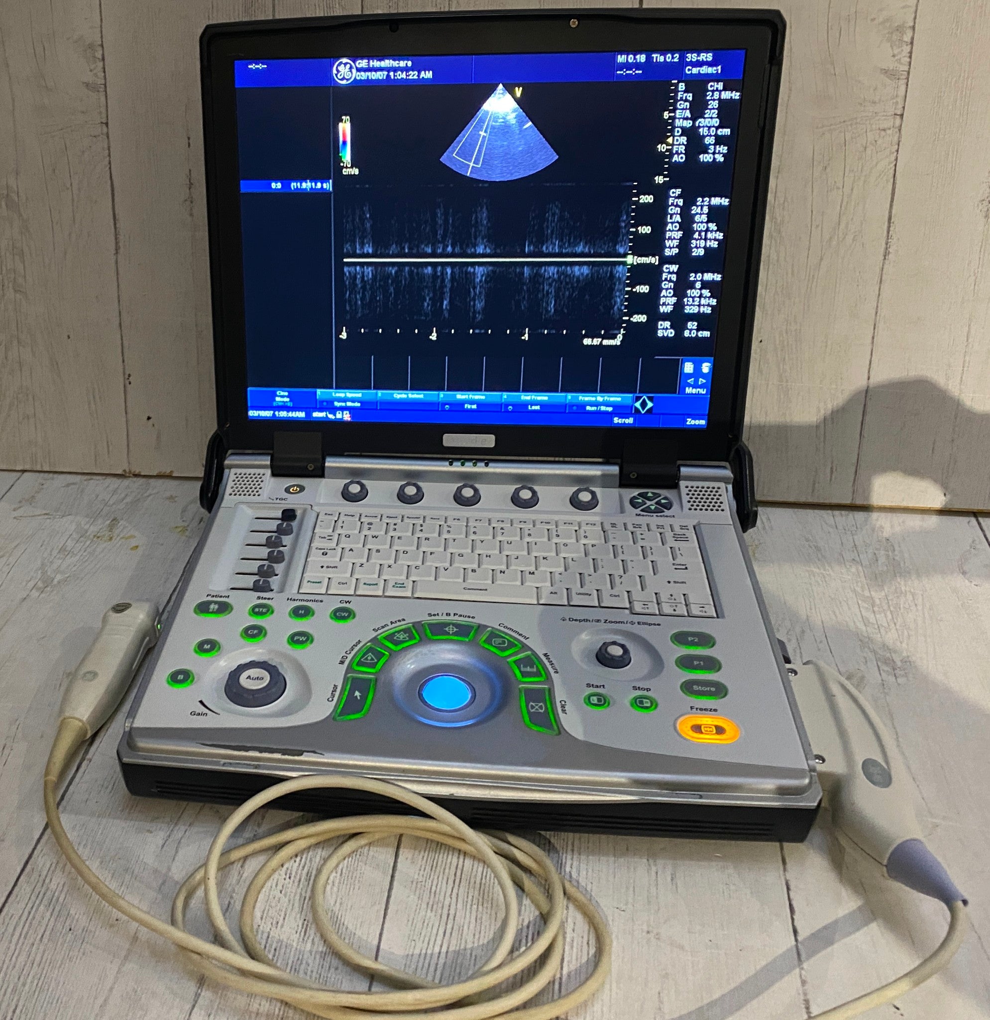 GE Vivid E Portable Ultrasound Scanner/Machine & Cardiac 3S-RS Probe 2013 DIAGNOSTIC ULTRASOUND MACHINES FOR SALE