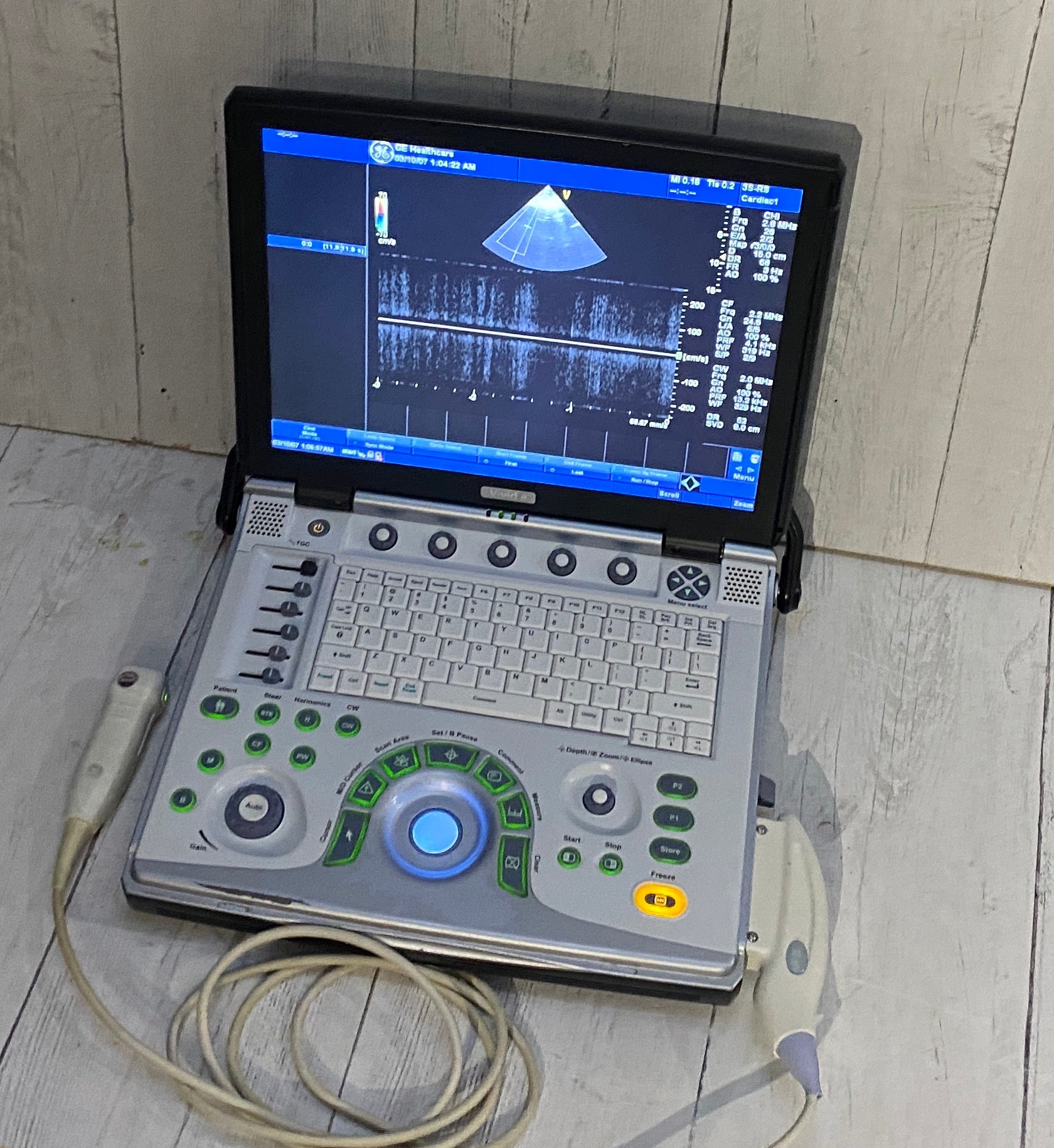 GE Vivid E Portable Ultrasound Scanner/Machine & Cardiac 3S-RS Probe 2013 DIAGNOSTIC ULTRASOUND MACHINES FOR SALE