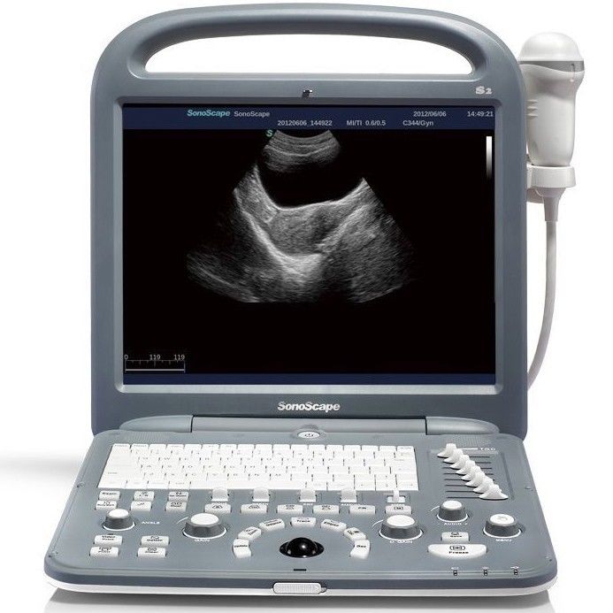 SonoScape S2 Portable Ultrasound System DIAGNOSTIC ULTRASOUND MACHINES FOR SALE