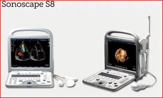 SonoScape S8 Ultrasound with 1 transducer (NEW) DIAGNOSTIC ULTRASOUND MACHINES FOR SALE