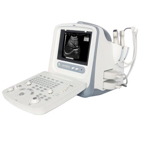 CHISON 8300 Portable Ultrasound w/ 1 probe (choice of linear or convex probe) DIAGNOSTIC ULTRASOUND MACHINES FOR SALE