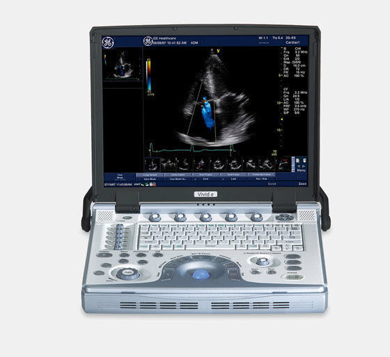 GE Vivid E Ultrasound System DIAGNOSTIC ULTRASOUND MACHINES FOR SALE