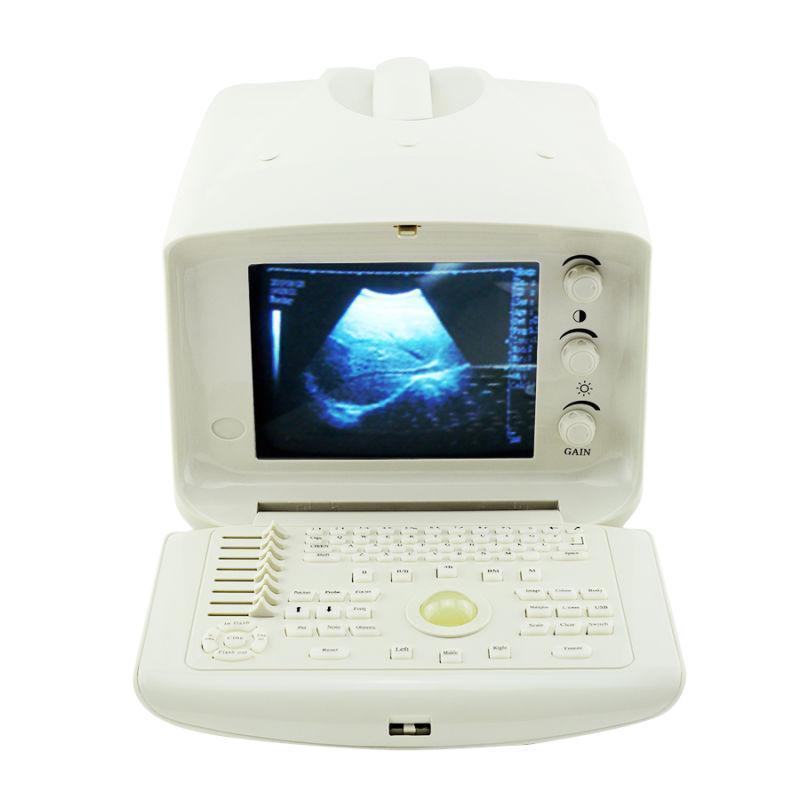 Ultrasonic scanner Portable Ultrasound Scanner Machine Micro-Convex  Probe 3D A+ DIAGNOSTIC ULTRASOUND MACHINES FOR SALE